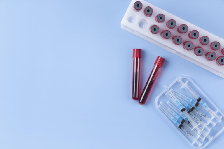 Read more about the article Diagnostyka PCOS – Jak zdiagnozować Zespół Policystycznych Jajników?